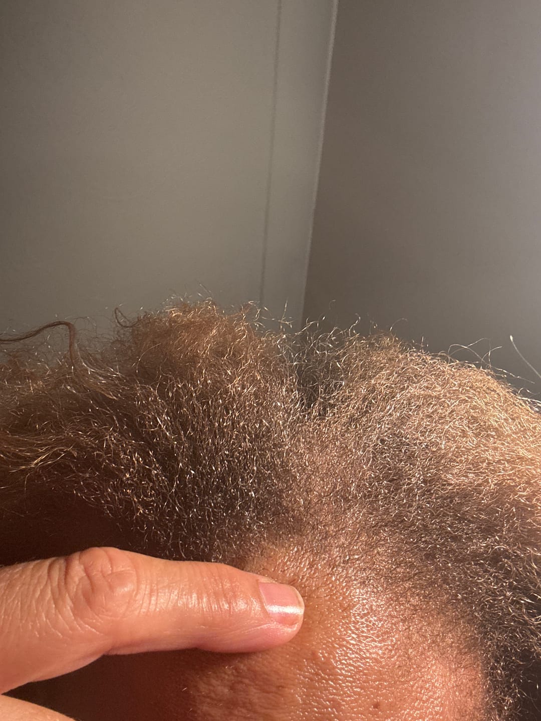 Customer photo review of XL BALM- Stimulating Scalp and Hair Balm