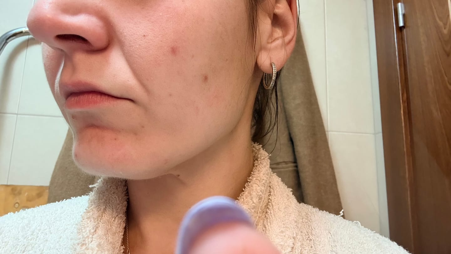 Customer photo review of A CONTROL + CORTIZEN - Equilibrio hormonal desde el cerebro, los ovarios, la piel y el metabolismo.