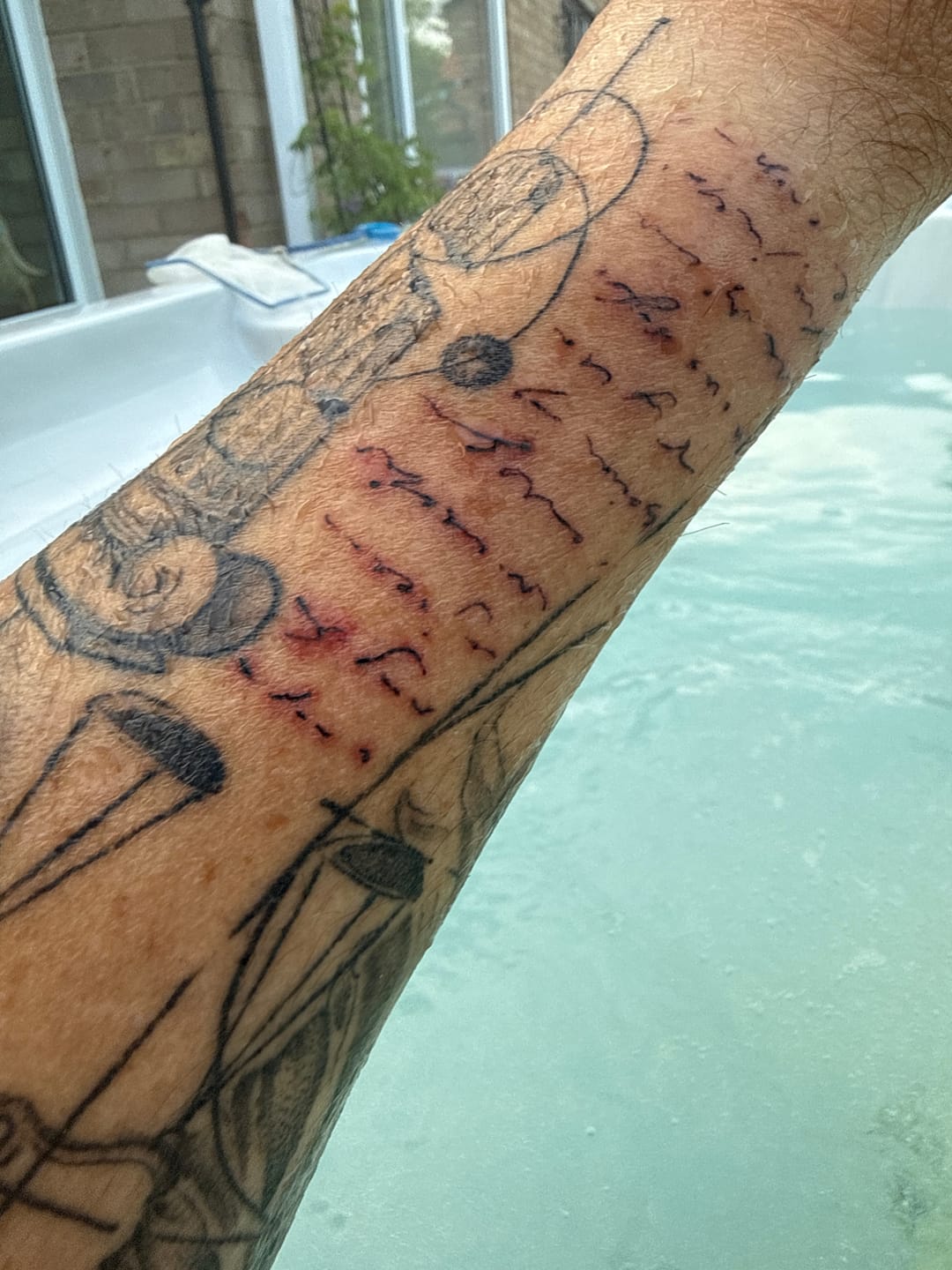 Customer photo review of TattooNumbx Platinumb Bundle