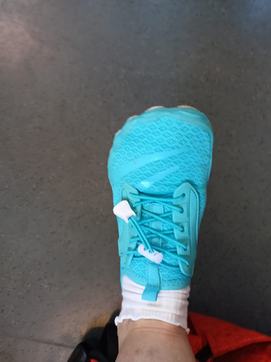 Customer photo review of Feel Pro