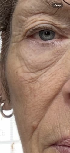 Close-up of reviewer's eye area before using Deep Collagen Cream, showing fine lines and wrinkles.
