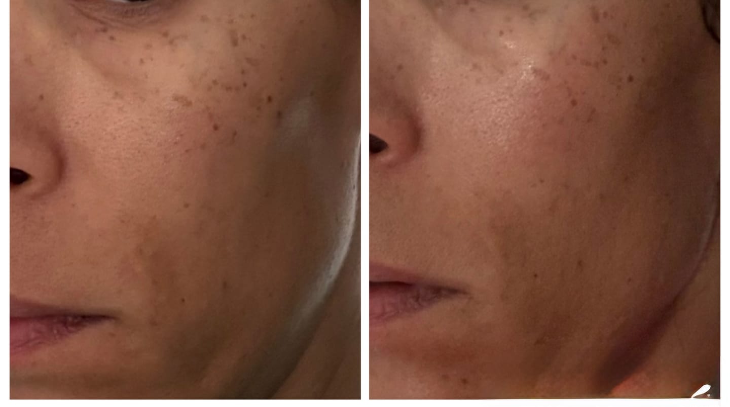Customer photo review of Turmeric Fade & Glow Bar.