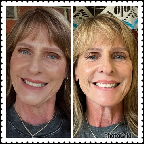 Reviewer's side-by-side comparison photo showing the results on their face after using Koriderm™ Time Reverse Cream.
