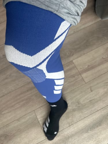 Customer photo review of Compression Sleeves V2 for Knees and Legs