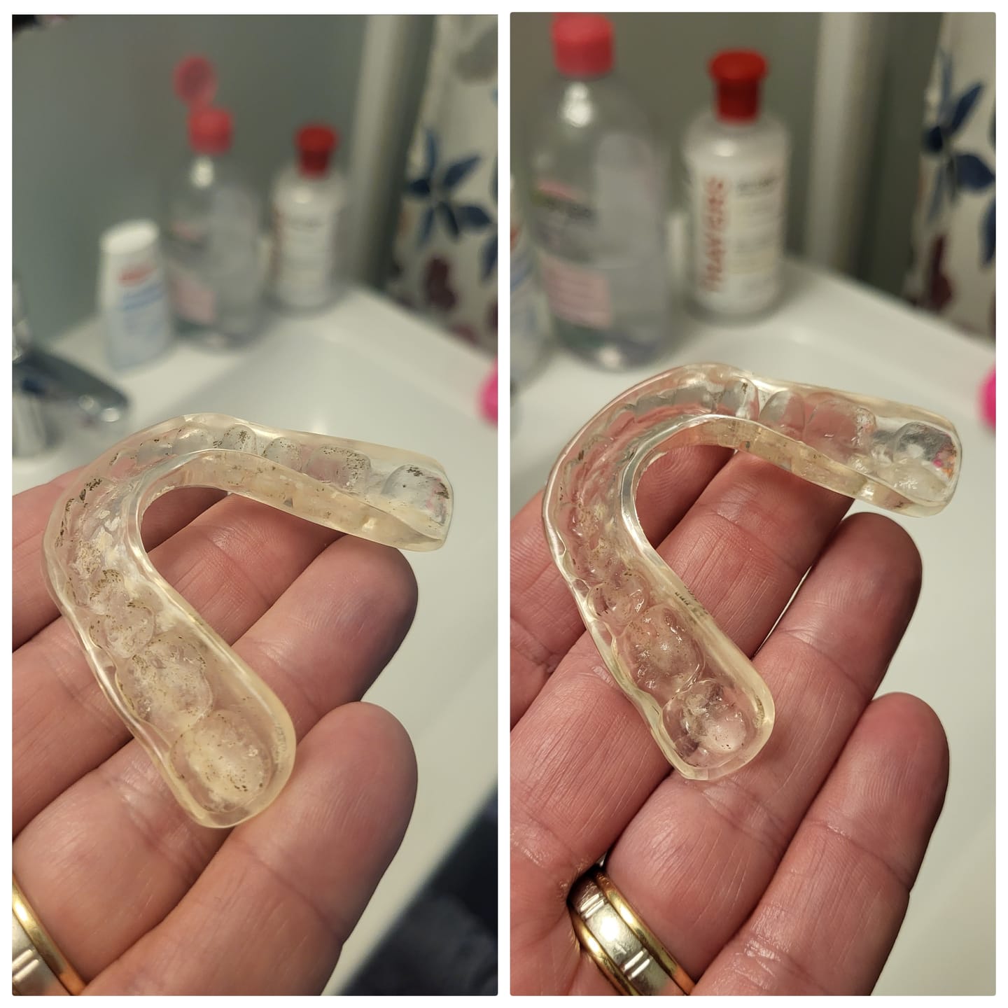Customer photo review of Dental Pod Pro