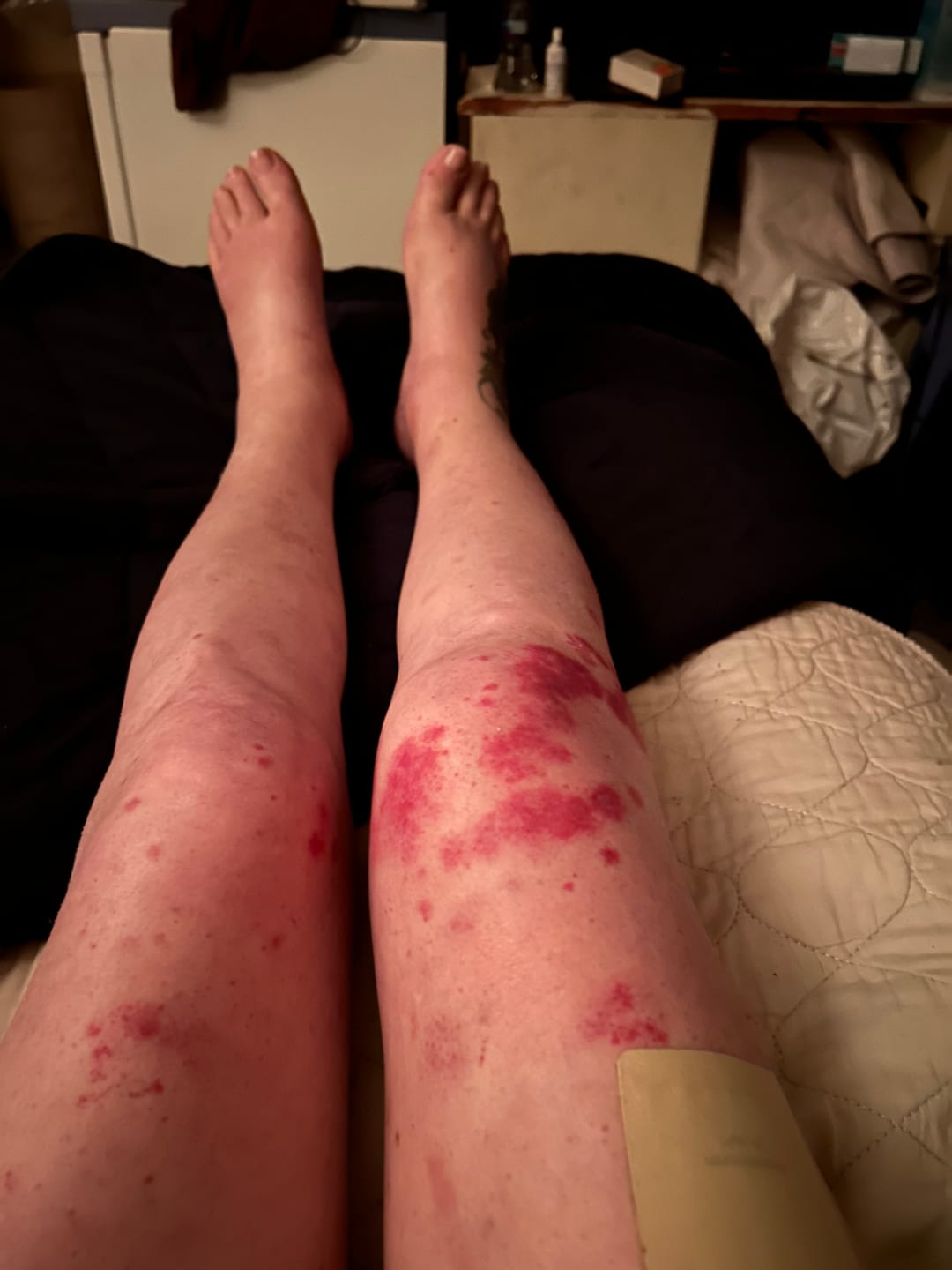 Customer photo review of Gentle Bundle | Face Cream & Tallow Soap