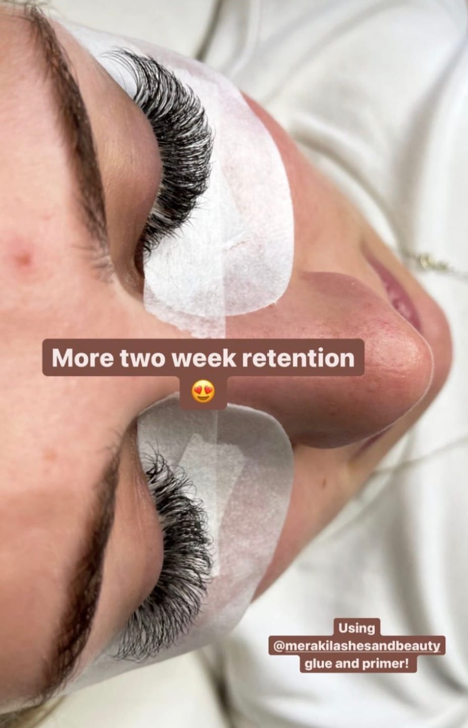 Customer photo review of MVP Lash Adhesive - Best-Selling Pro Glue | 7-Week Retention, 1-2s Dry Time | 10ml