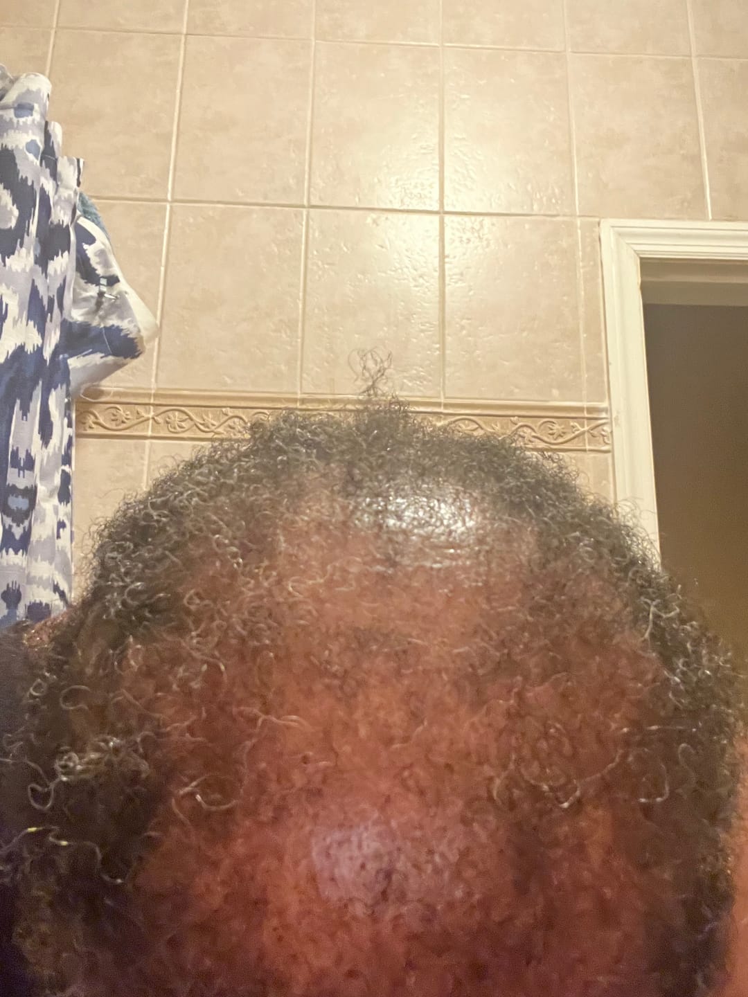 Customer photo review of Ultimate Healthy Hair Care Bundle - Limited Edition
