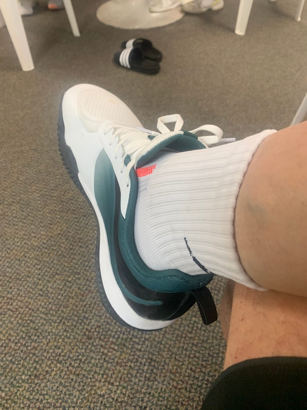 Customer photo review of Extra Arch Support Insoles