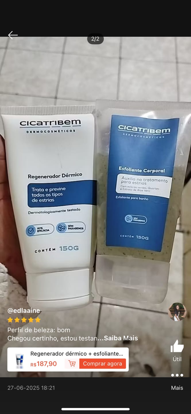 Customer photo review of Creme Antiestrias Regenerador Dérmico