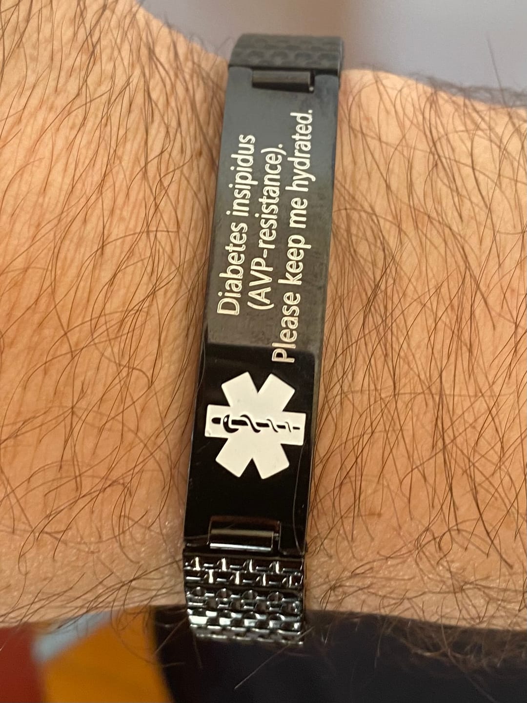 Customer photo review of Black Plated Stainless Steel Medical Alert ID Stretchable Bracelet