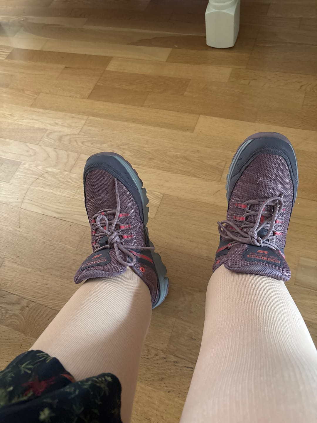 Customer photo review of EverSock™ Wide Compression Socks For Pain Relief