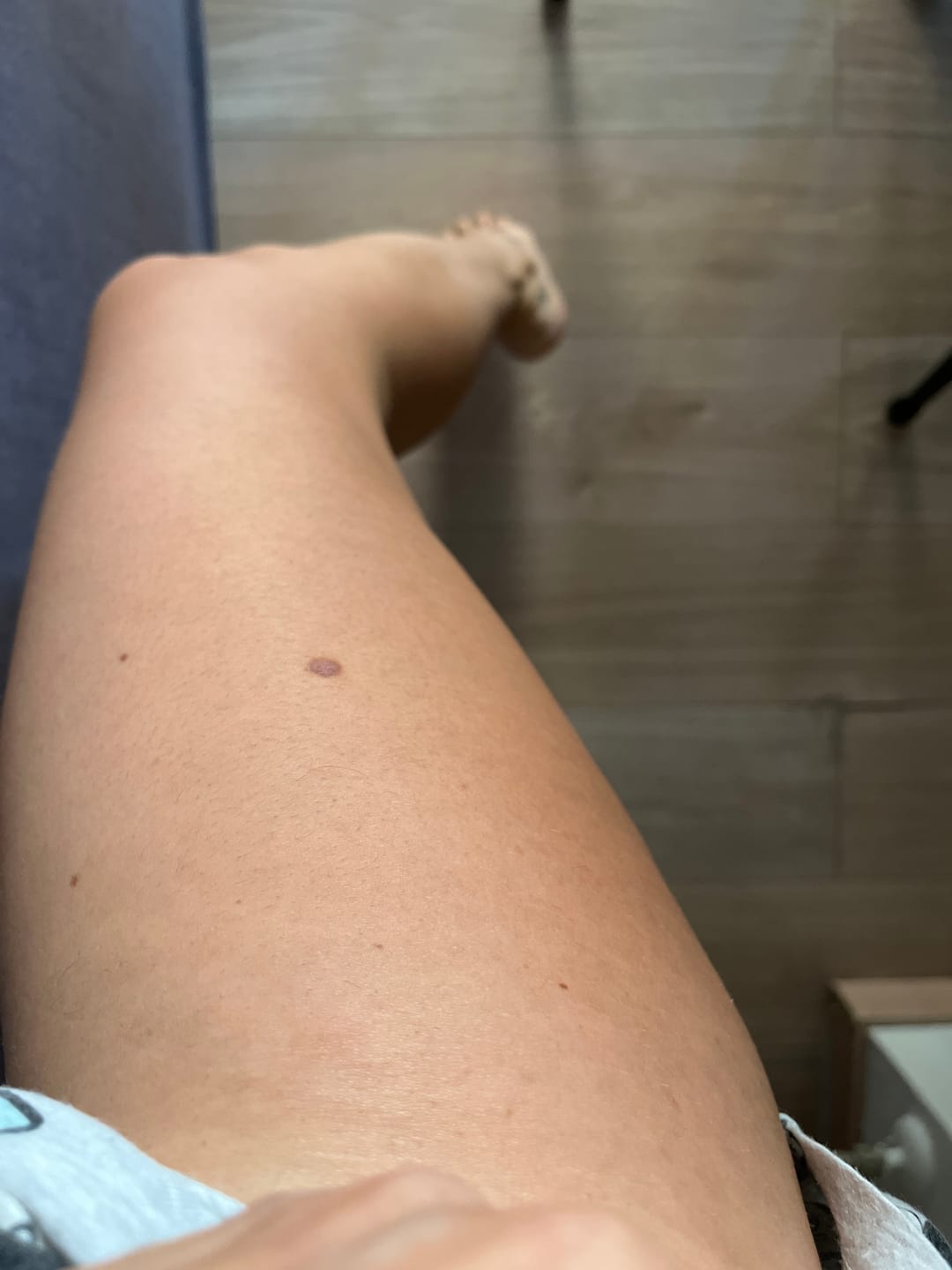 Customer photo review of Crema cellulite effetto caldo