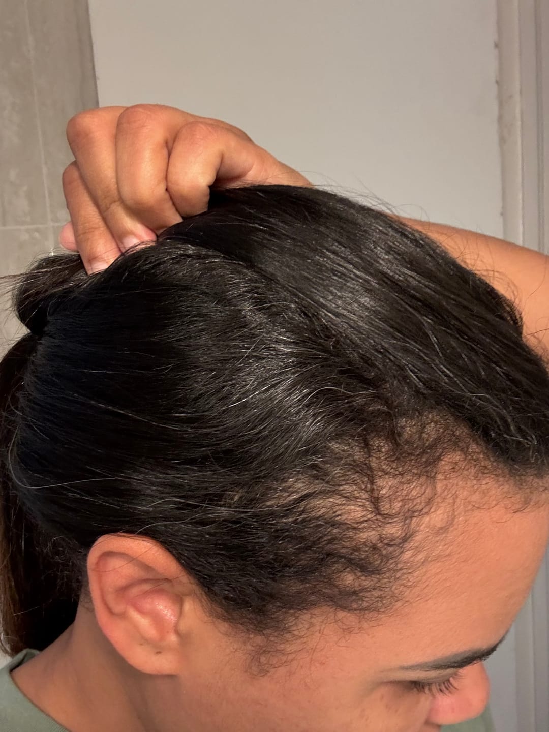 Customer photo review of JUMBO Scalp Stimulator