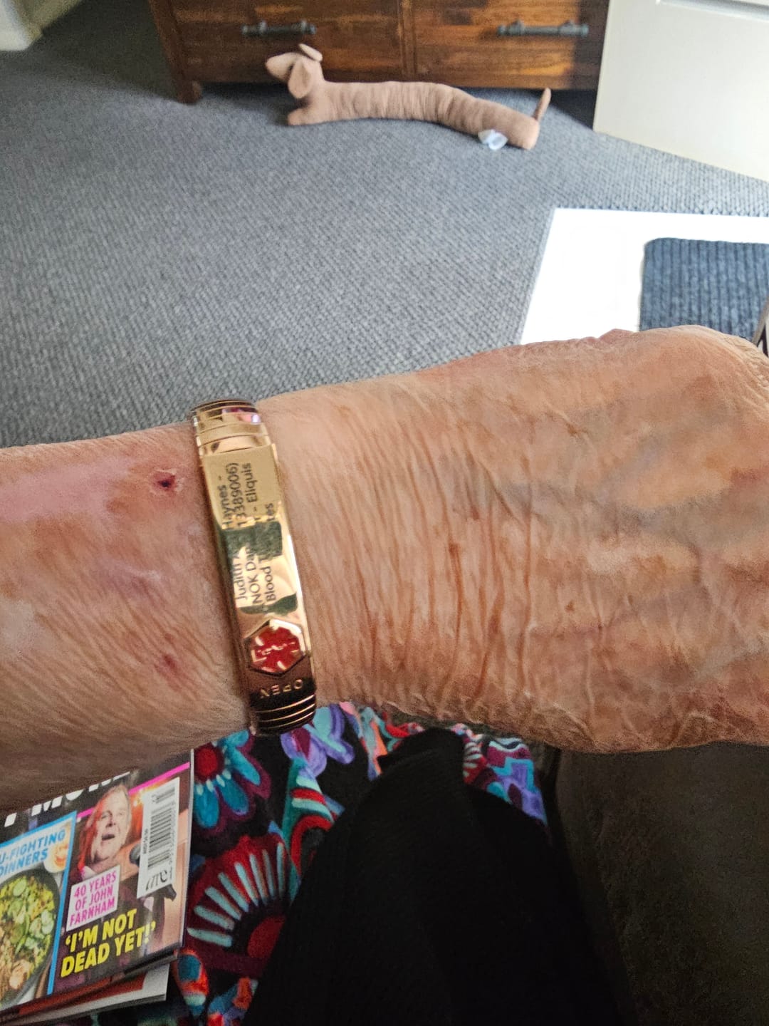 Customer photo review of Rose Vault Medical ID Bracelet
