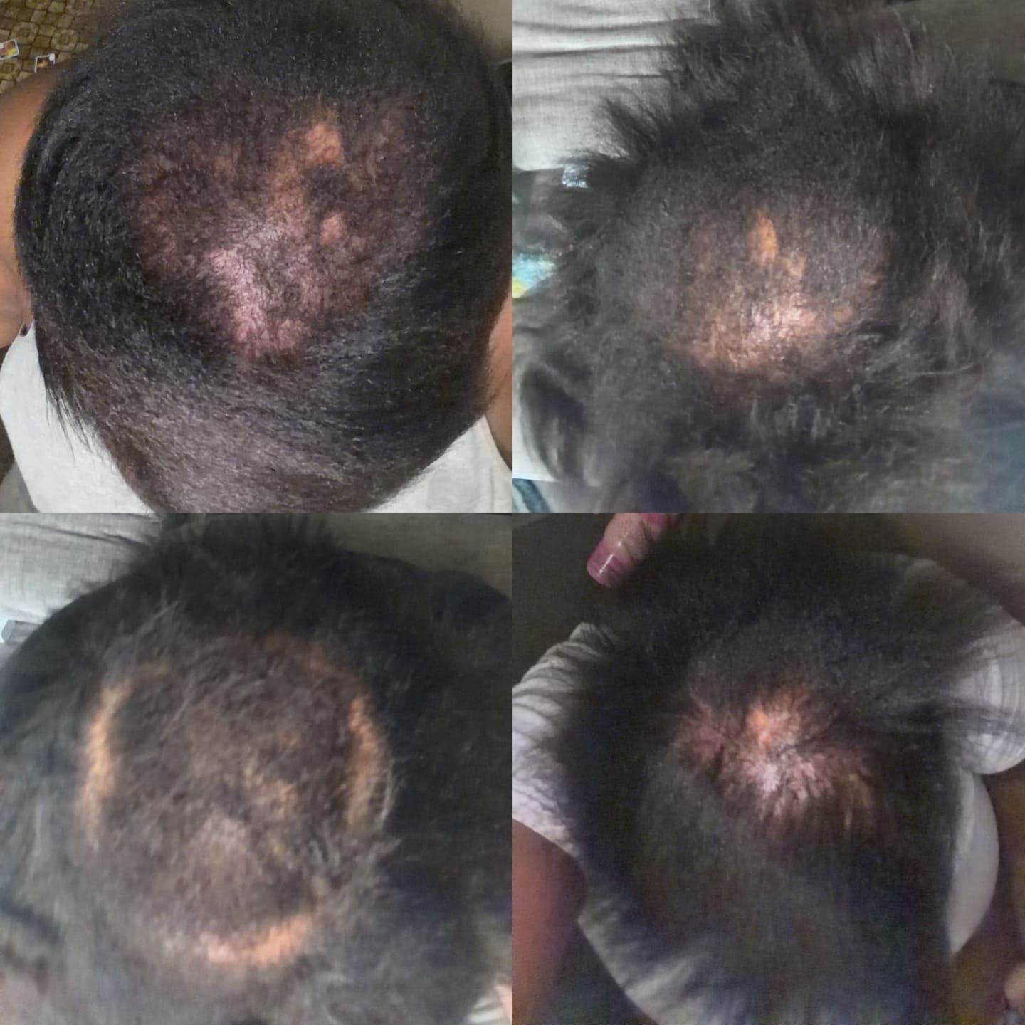 Customer photo review of Strengthen & Replenish Shampoo and Conditioner Set - Anti-Breakage