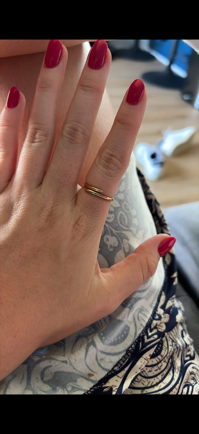 Customer photo review of Classic Claw Ring