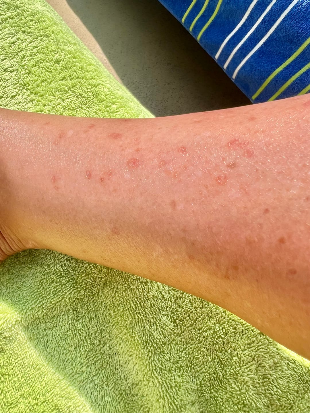 Customer photo review of Calm Balm