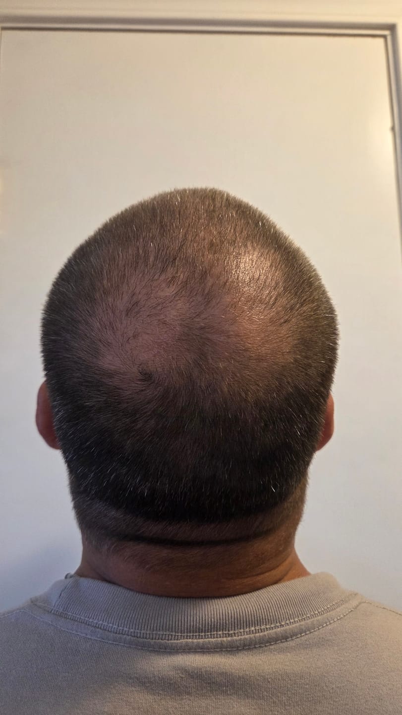 Customer photo review of Spartan™ Root Activator Shampoo 6 Bottles(sc)