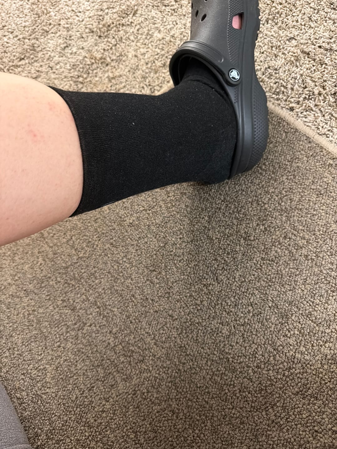 Customer photo review of Premium Anti-Fatigue Bamboo Footsleeves