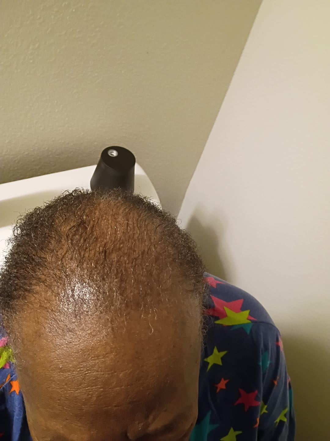 Customer photo review of Batana Oil