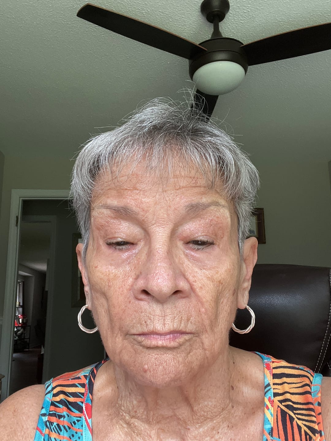 Customer photo review of Koriderm™ Time Reverse Cream (All-In-One)