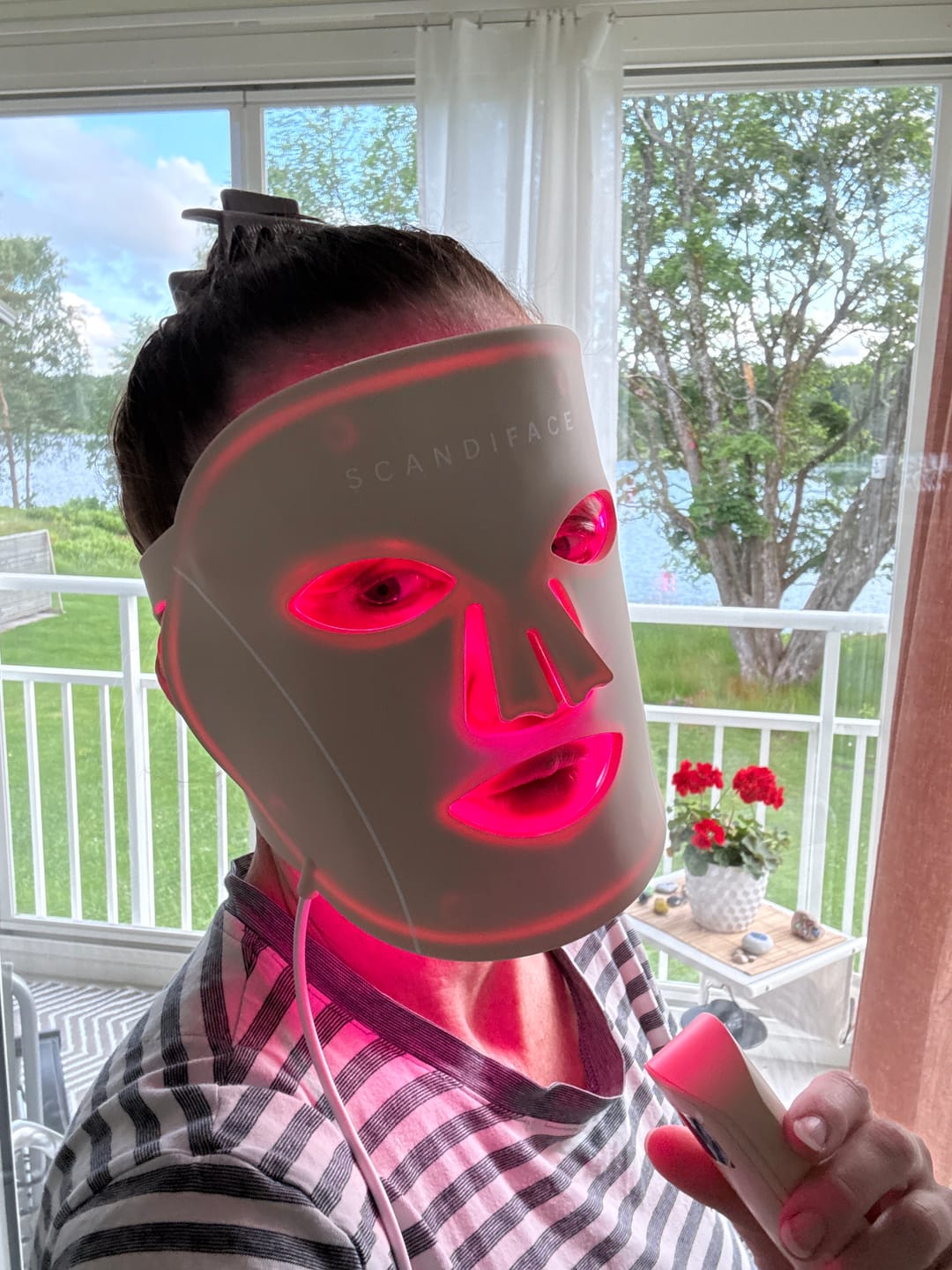 Customer photo review of Skinboosting LED mask