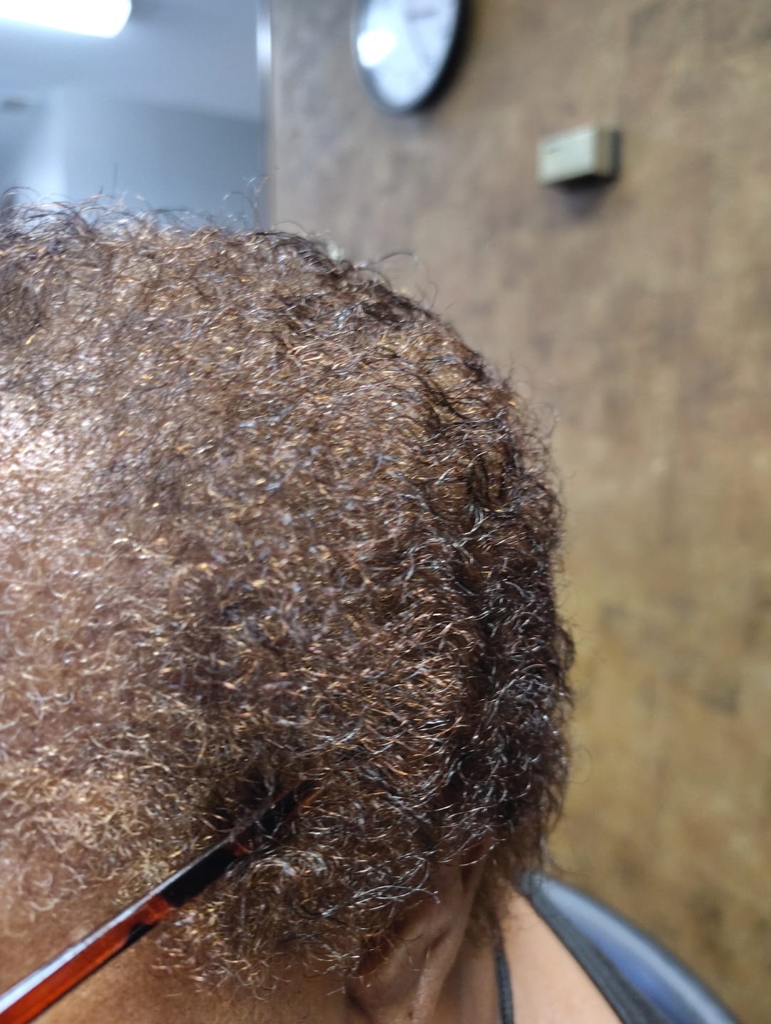 Customer photo review of Rennora Hair Growth Serum