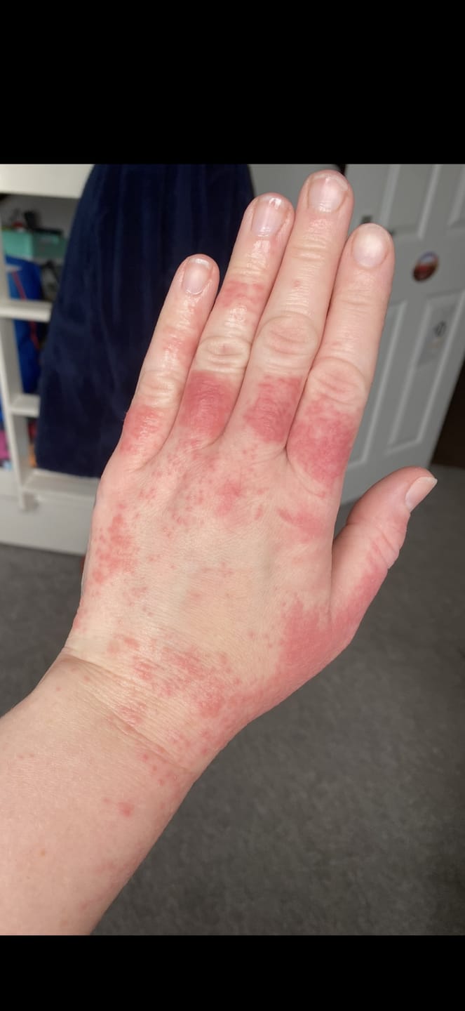 Customer photo review of Grass-Fed Tallow Body Balm | Cold Weather Protection