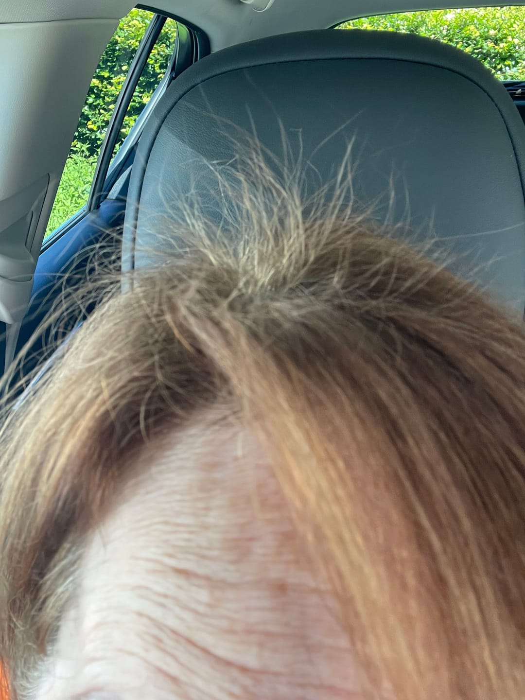 Customer photo review of VITAFOAM ™ Hair Growth Formula