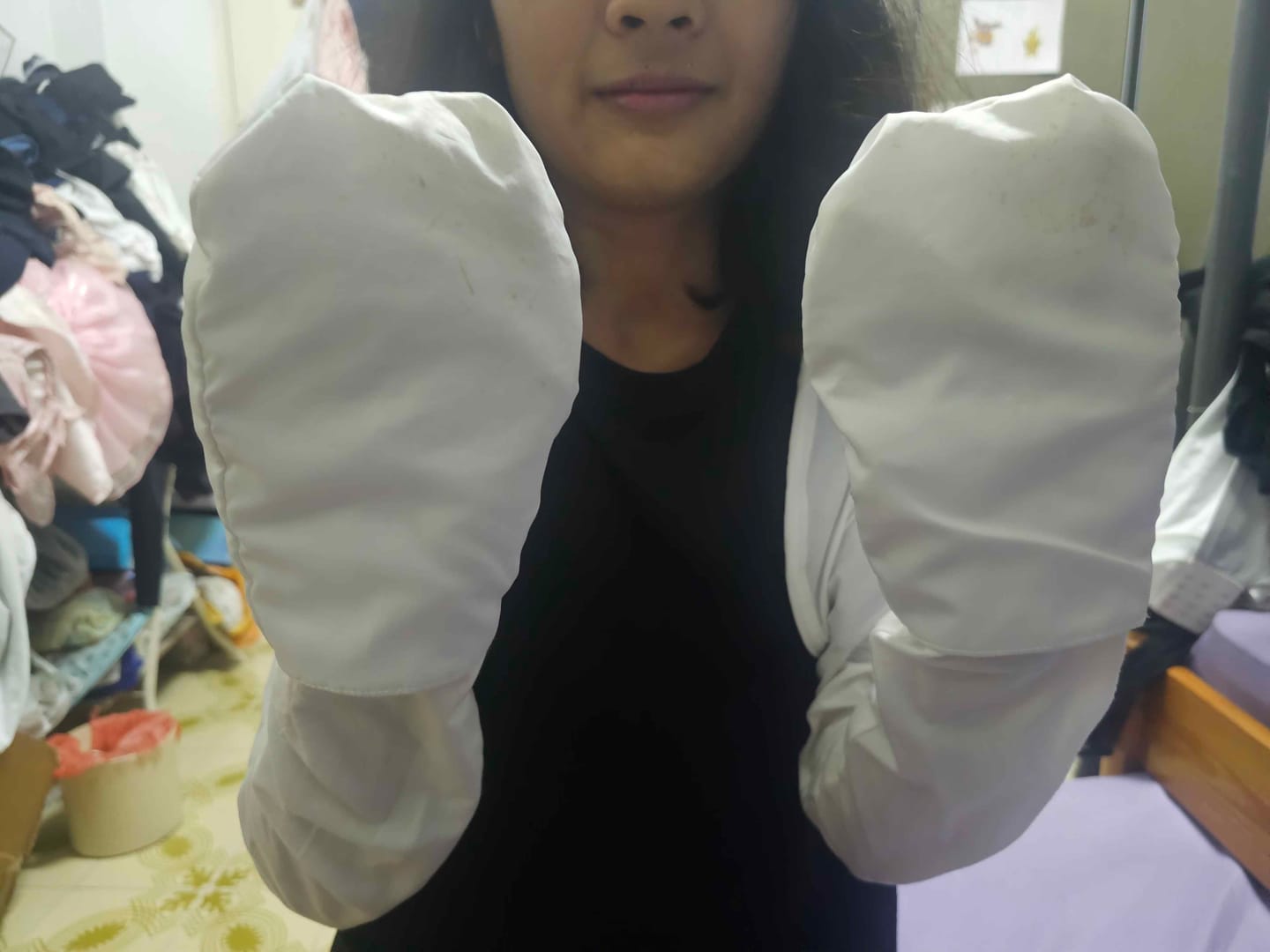 Customer photo review of Eczema Scratch Mitten