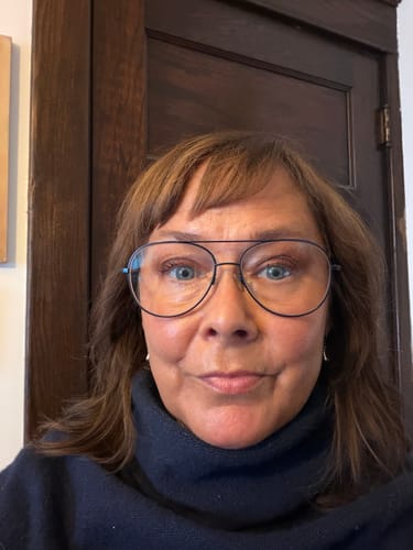 Reviewer's face in a progress photo showing skin results after using the Seranova Microneedling Infusion System.