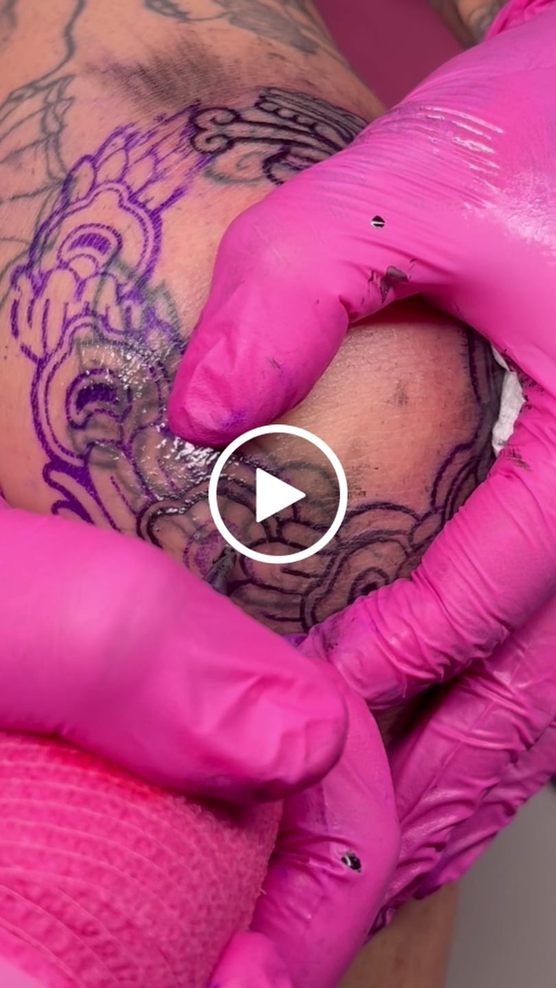 Customer video review of TattooNumbx Tattoo Bundle