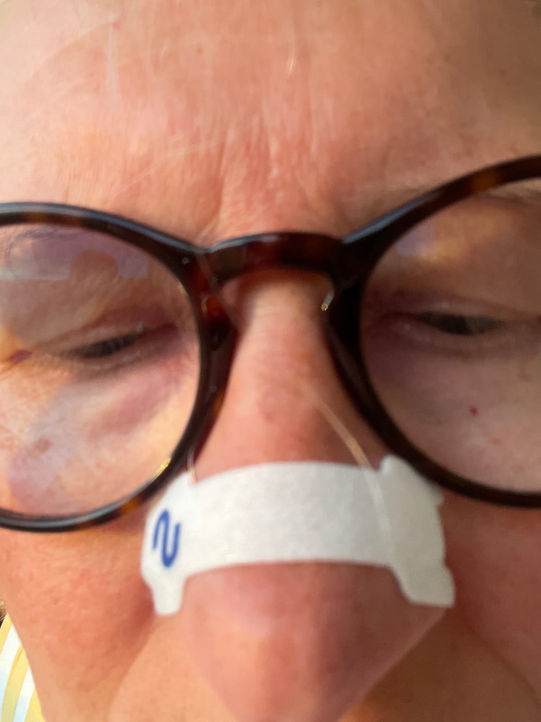Customer photo review of Nuku Sleep Nasal Strips