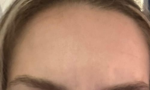 Customer photo review of Photon X Anti-Aging-Bundle