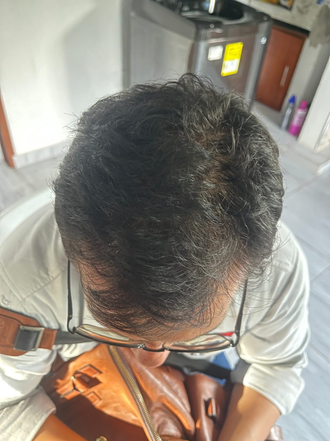 Customer photo review of Tónico Capilar de Romero  · Crecimiento y Anticaída