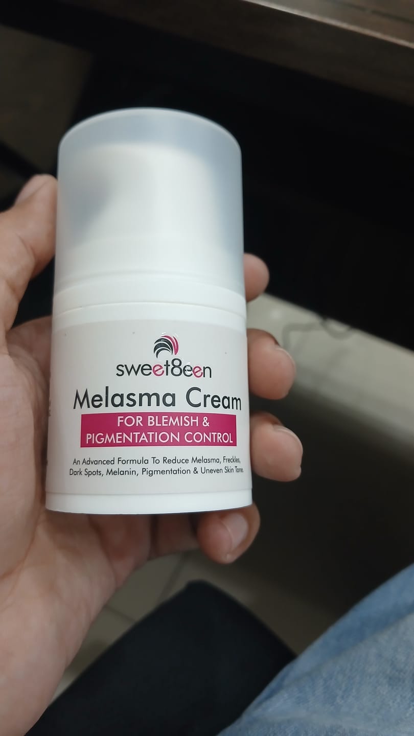 Customer photo review of Melasma Cream
