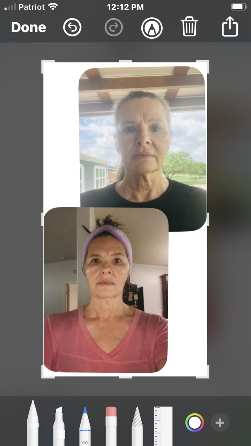 Customer photo review of INIA GLOW 4D 940nm Dual NIR Wireless LED Mask FDA-Cleared