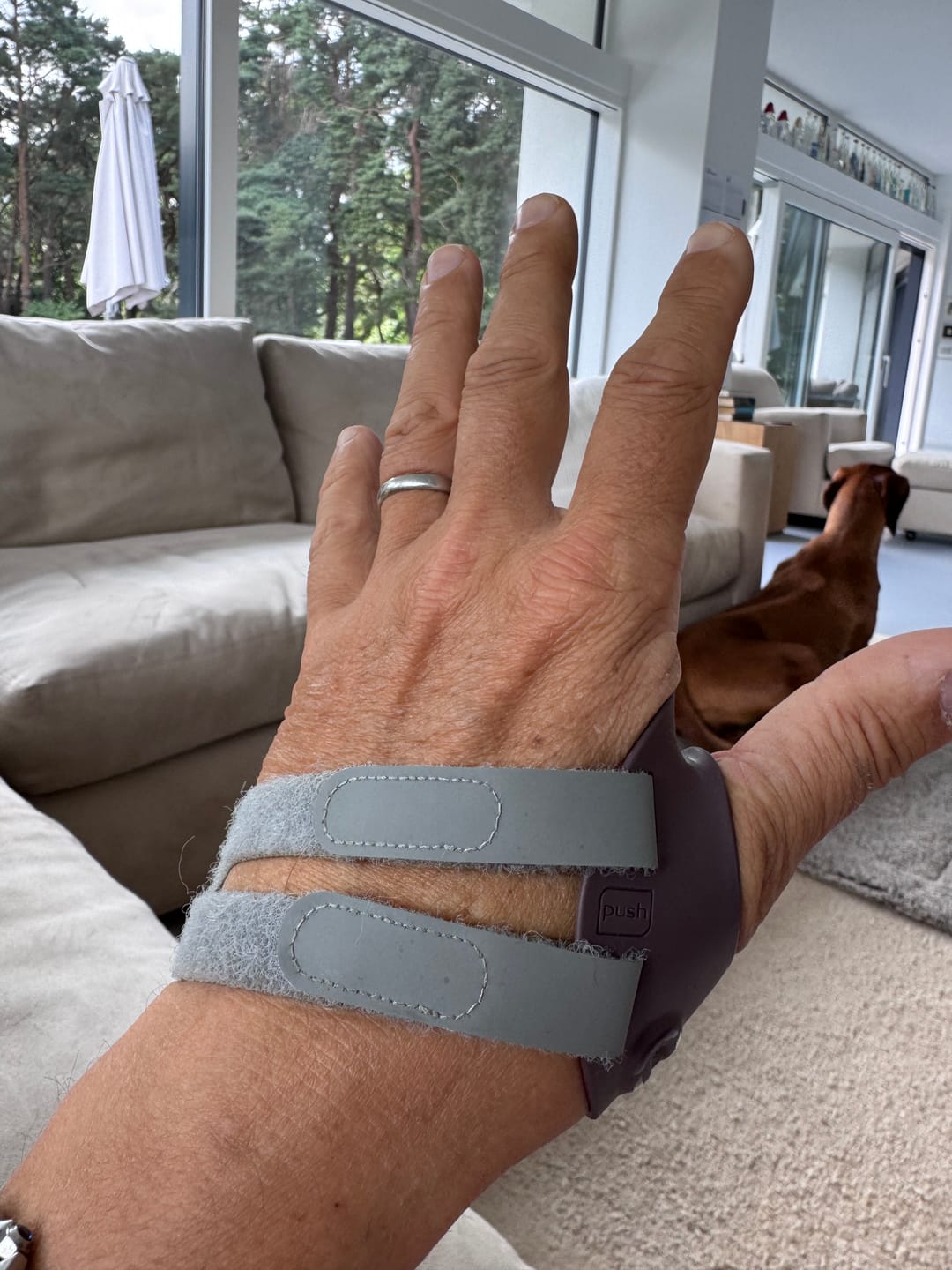 Customer photo review of Push Ortho CMC Thumb Brace – Osteoarthritis Support Splint for Thumb Joint Stabilisation