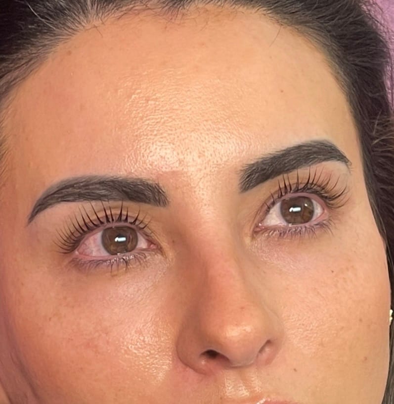 Customer photo review of LASH LIFT CAPSULES WITH CYSTAMINE