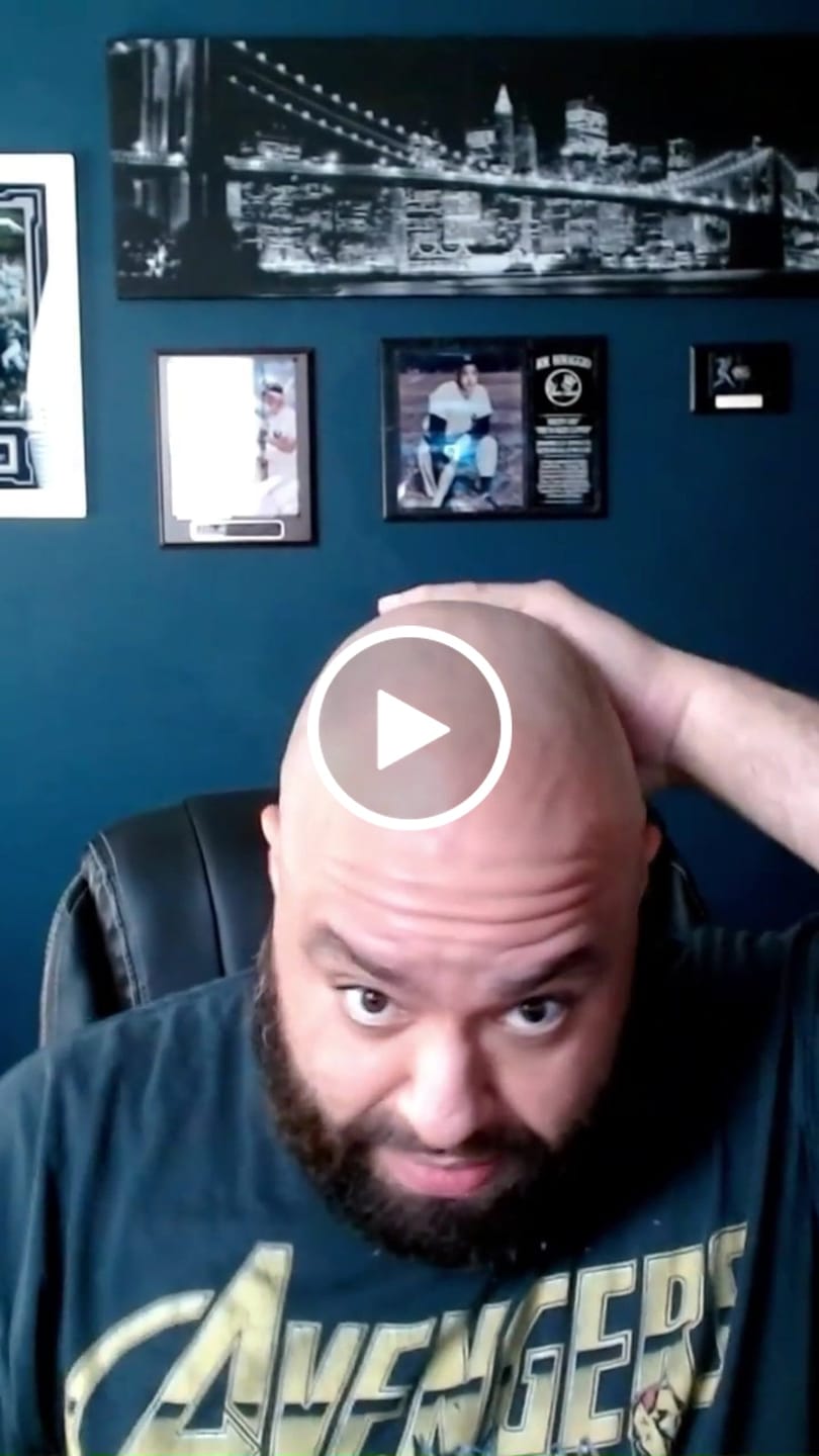 Customer video review of Natural Biotin DHT Blocker Spray - Best Hair Growth Spray for Men's and Women's Hair Loss and Thinning Hair