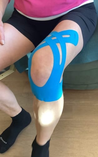 Customer photo review of Romea ActiveTape™ - Stödjande Knätejp