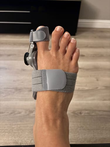 Customer wearing the adjustable grey Treatmedy™ Bunion Fix on their foot.