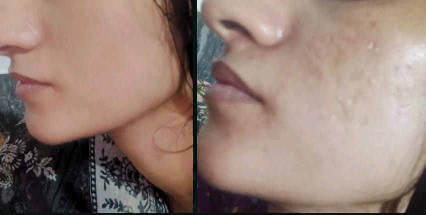 Customer photo review of Maxdif Brightening Serum