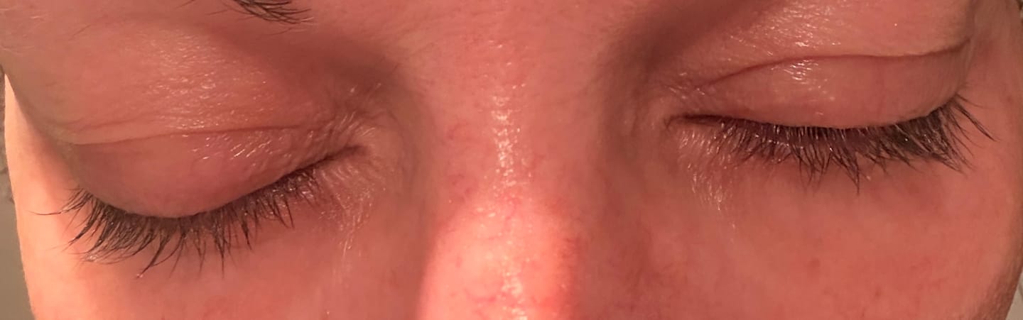 Customer photo review of Eyelash Serum