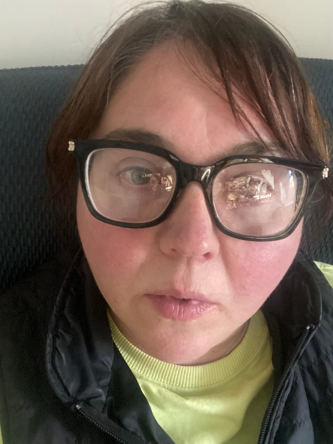 Customer photo review of Rosalique 3 in 1 Anti-Redness Miracle Formula SPF50