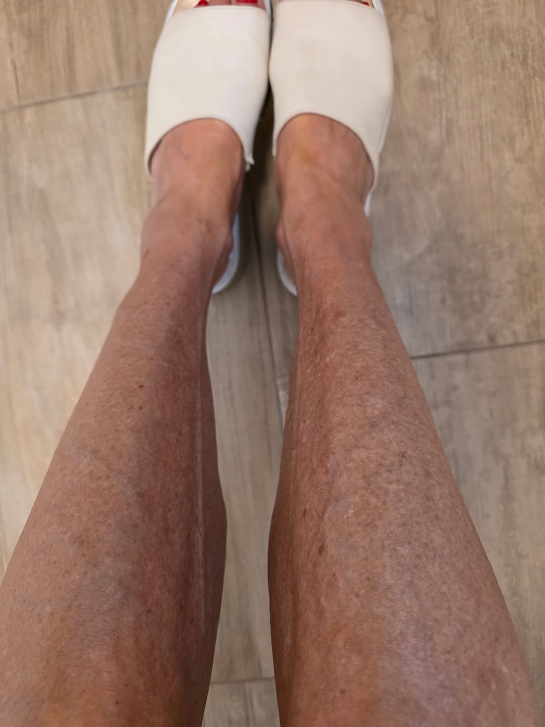 Customer photo review of 5x Belle Body Haarentfernung inkl. Gratis Enthaarungscreme