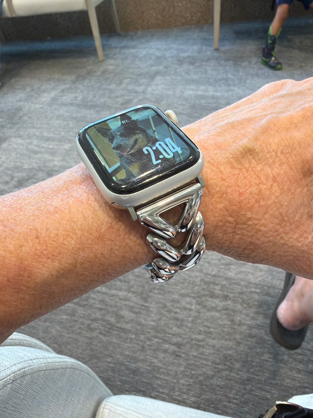 Customer photo review of Platinum Braid Luxury Apple Watch Strap
