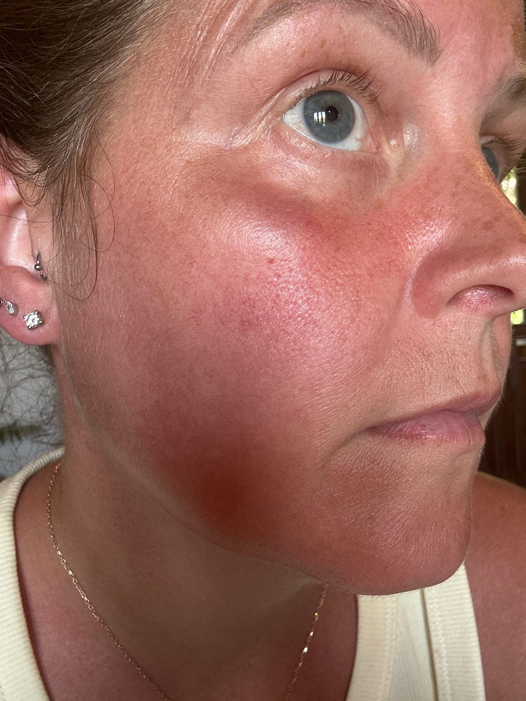 Customer photo review of Whipped Grass-Fed Tallow Face Cream | With Sweet Almond Oil