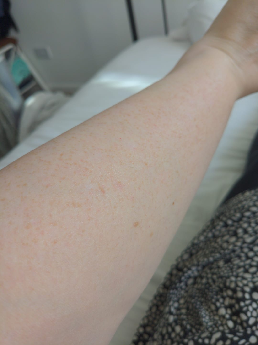 Customer photo review of Calm Cream